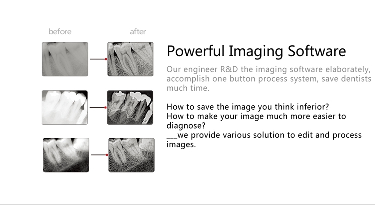 XR45 Intraoral Sensor HDR-500